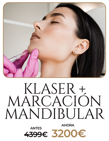 Klazer + Marcación Mandibular