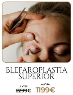 Blefaroplastia superior