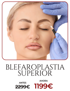 Blefaroplastia superior